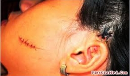 Bản tin 113 – chiều 15/9: Bắt giữ kẻ đánh ghen, rạch mặt tình địch…